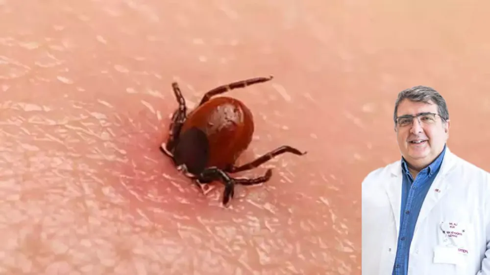 Kene ısırığında erken müdahale önemli! 