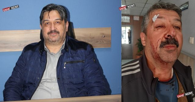 “Darp eden kardeşim değil doktor”